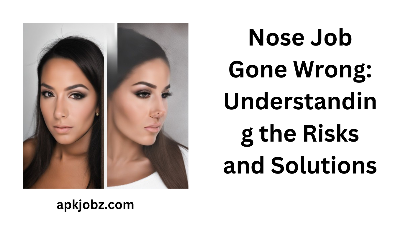 Nose Job Gone Wrong: Understanding the Risks and Solutions